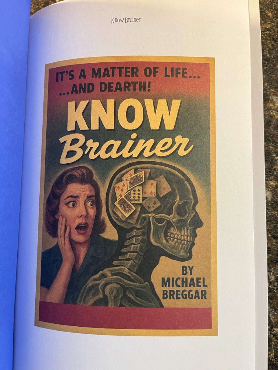 Know Brainer - Michael Breggar