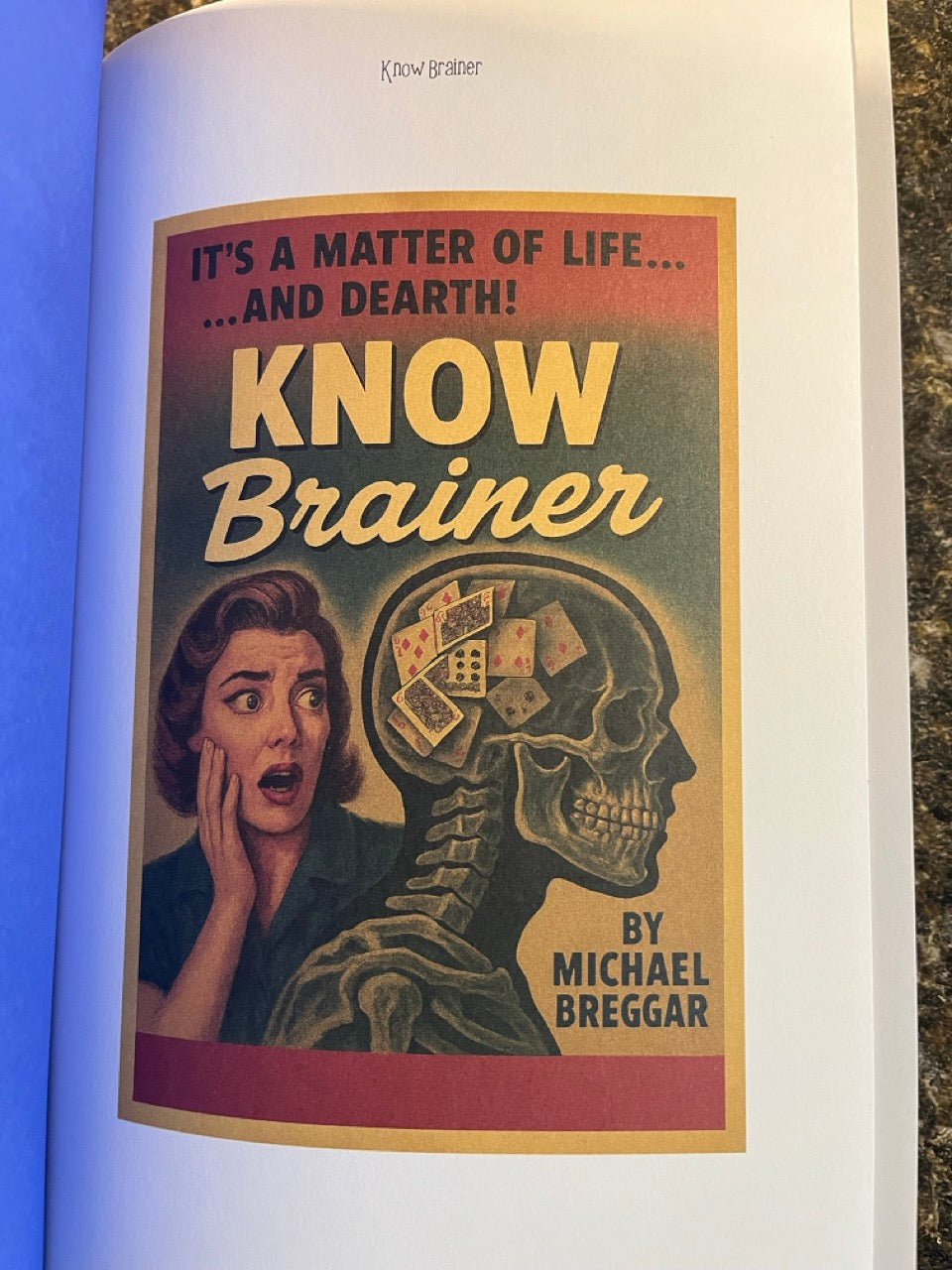 Know Brainer - Michael Breggar