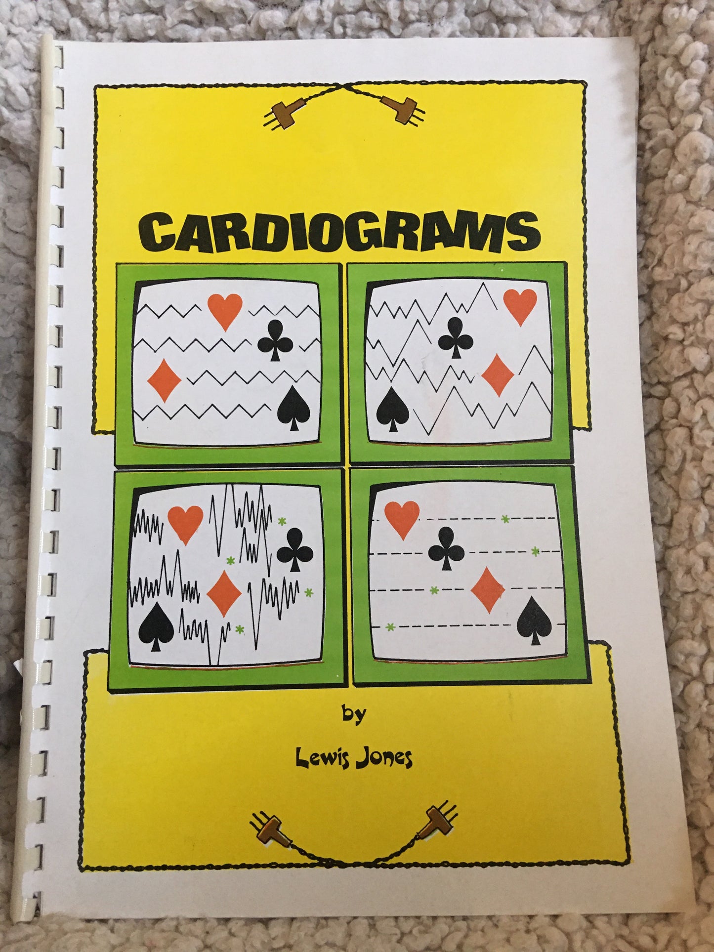 Cardiograms - Lewis Jones